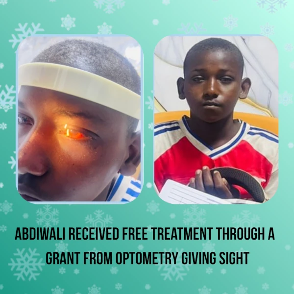 Photos of young boy with eye disease that was treated thanks to a project supported by a grant from Optometry Giving Sight.